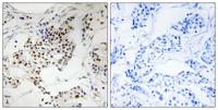 Sgo2 Polyclonal Antibody