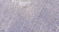 SH2D4A Polyclonal Antibody