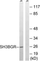 SH3BGR Polyclonal Antibody