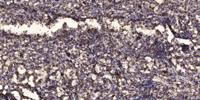 SH3BGR Polyclonal Antibody