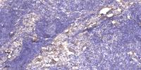 Shank 2 Polyclonal Antibody