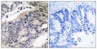 ACSS1 Polyclonal Antibody