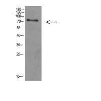 ACSS1 Polyclonal Antibody