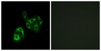 ACSVL4 Polyclonal Antibody