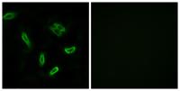 ACSVL6 Polyclonal Antibody