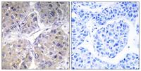ACSVL6 Polyclonal Antibody