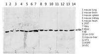 Actin Polyclonal Antibody