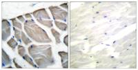 Actin Polyclonal Antibody
