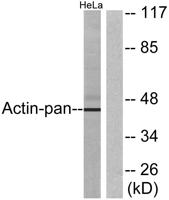 Actin Polyclonal Antibody