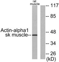 Actin α1 Polyclonal Antibody