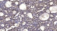 Shb Polyclonal Antibody