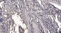 SHIP-1 Polyclonal Antibody