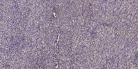SHIP-1 Polyclonal Antibody
