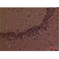 SHIP-2 Polyclonal Antibody