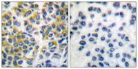 SH-PTP1 Polyclonal Antibody