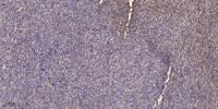 SH-PTP1 Polyclonal Antibody