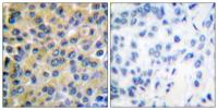 SH-PTP2 Polyclonal Antibody