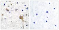 SH-PTP2 Polyclonal Antibody