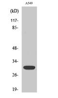 Siah-1/2 Polyclonal Antibody