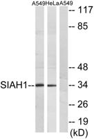 Siah-1/2 Polyclonal Antibody