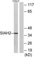 Siah-2 Polyclonal Antibody