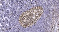 Siah-2 Polyclonal Antibody