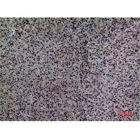 Siglec-5/14 Polyclonal Antibody