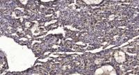 SIK1 Polyclonal Antibody