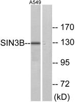 Sin3B Polyclonal Antibody