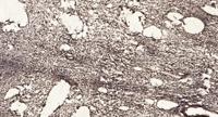 Sin3B Polyclonal Antibody