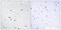 SIP1 Polyclonal Antibody