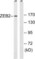 SIP1 Polyclonal Antibody