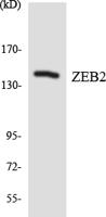 SIP1 Polyclonal Antibody