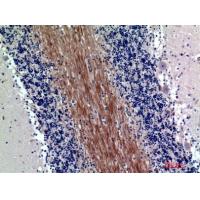 SIRP-α1/β1 Polyclonal Antibody