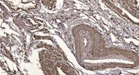 SIRT2 Polyclonal Antibody