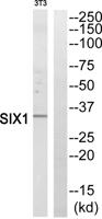 Six1 Polyclonal Antibody