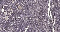 Six1 Polyclonal Antibody