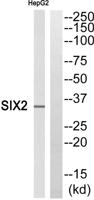 Six2 Polyclonal Antibody