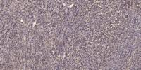 Six2 Polyclonal Antibody