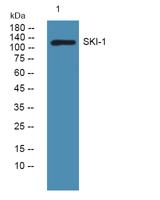 SKI-1 Polyclonal Antibody