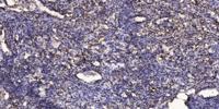 SKI-1 Polyclonal Antibody