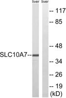 SLC10A7 Polyclonal Antibody