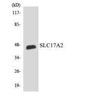 SLC17A2 Polyclonal Antibody