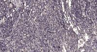 SLC17A2 Polyclonal Antibody