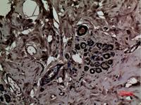 SLC6A14 Polyclonal Antibody