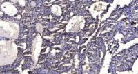 SLC6A15 Polyclonal Antibody