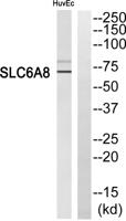 SLC6A8 Polyclonal Antibody