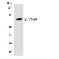 SLC6A8 Polyclonal Antibody