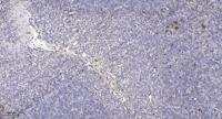 SLC6A8 Polyclonal Antibody