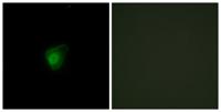 SMG7 Polyclonal Antibody